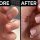 Methods and tips to stop biting your nails